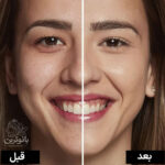 کانسیلر لورال 323 اینفالیبل 24 ساعته