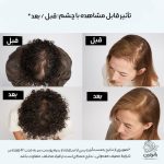 شامپو تقویت‌کننده رشد و ضد ریزش مو لورال