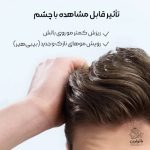سرم ضد ریزش و تقویت‌کننده رشد مو سر لورال