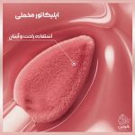 تینت لب لورال