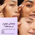سرم دور چشم رویتالیفت فیلر هیالورونیک اسید و کافئین ضد چروک و روشن کننده لورال