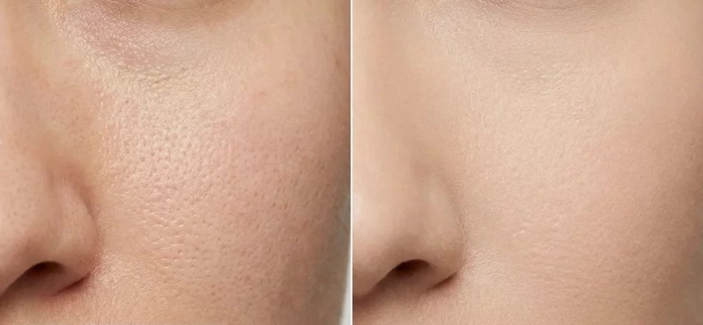 نحوه استفاده از پرایمر لورال